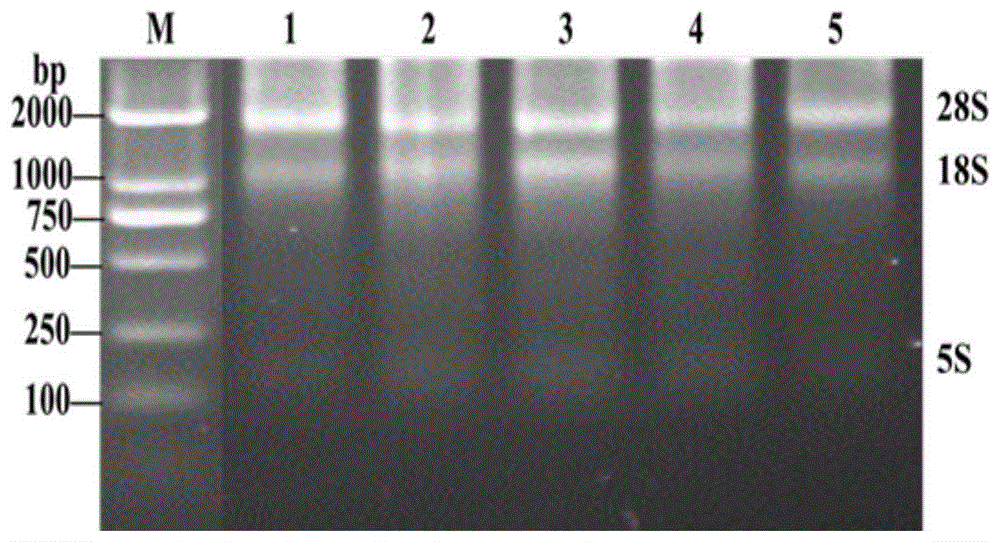 一种柑橘黄龙病菌荧光定量分析的内参基因及其应用的制作方法