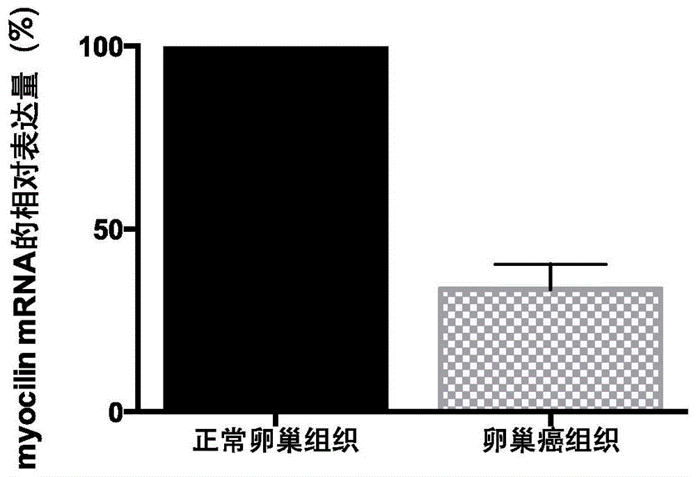 一种卵巢癌的诊断标志物及其应用的制作方法