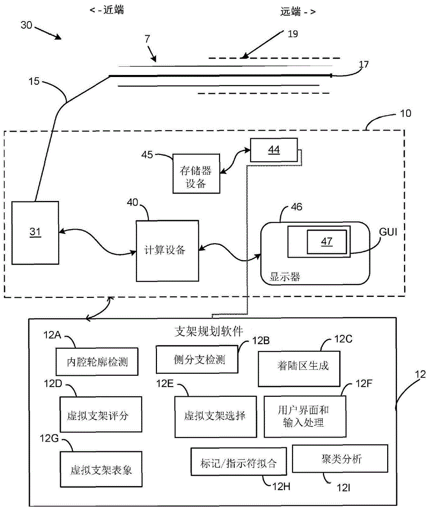 利用血管表象的支架规划系统及方法与流程