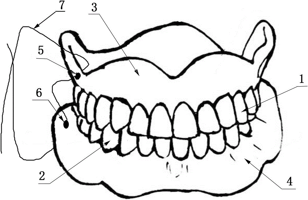 柔性连接的上下义齿的制作方法