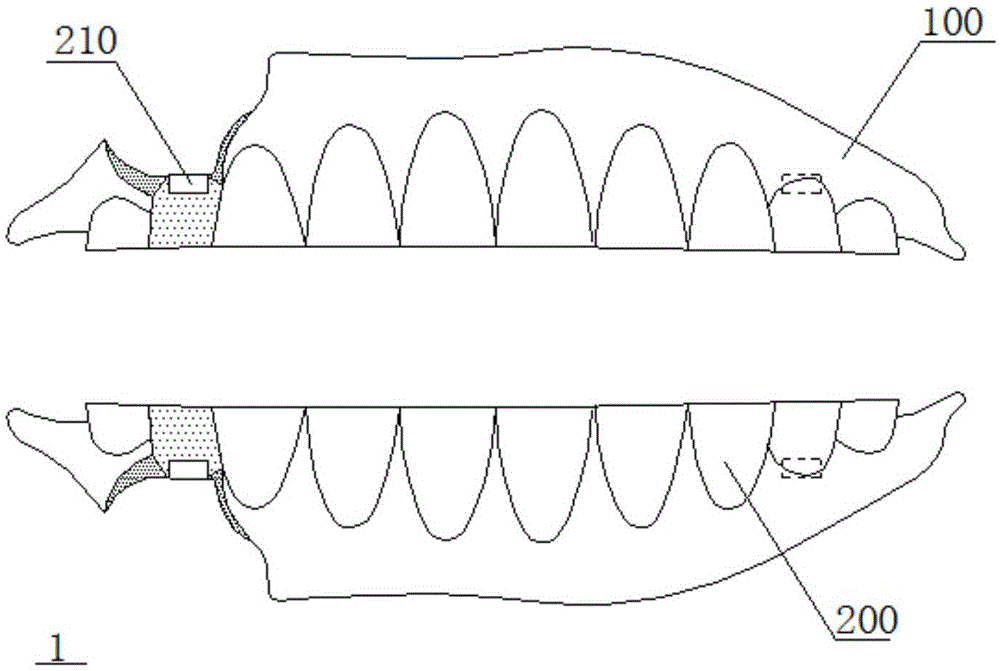 全口义齿及义齿组件的制作方法