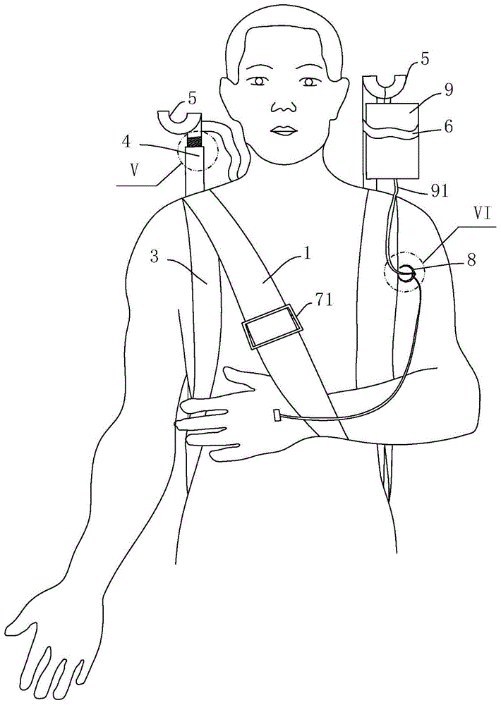 一种用于输液的背背夹的制作方法