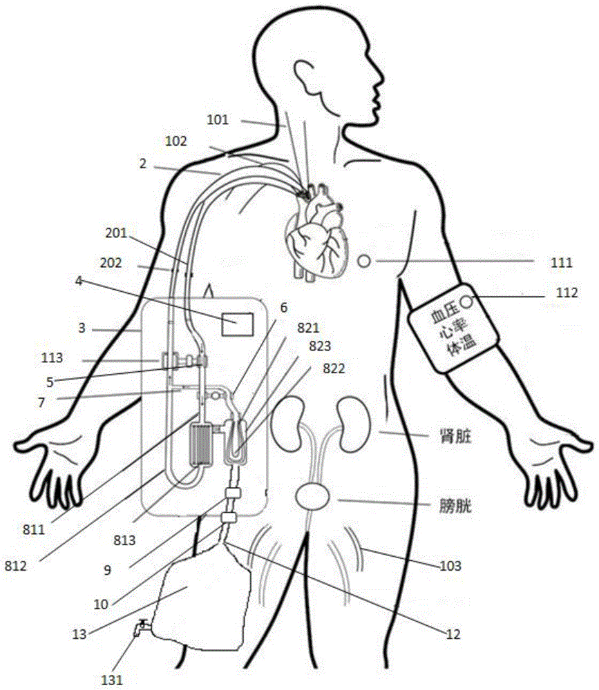 一种微型人工肾仪的制作方法