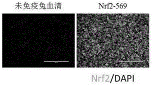 一种鸡Nrf2蛋白抗体及其免疫原、免疫原性多肽、检测试剂盒和应用的制作方法