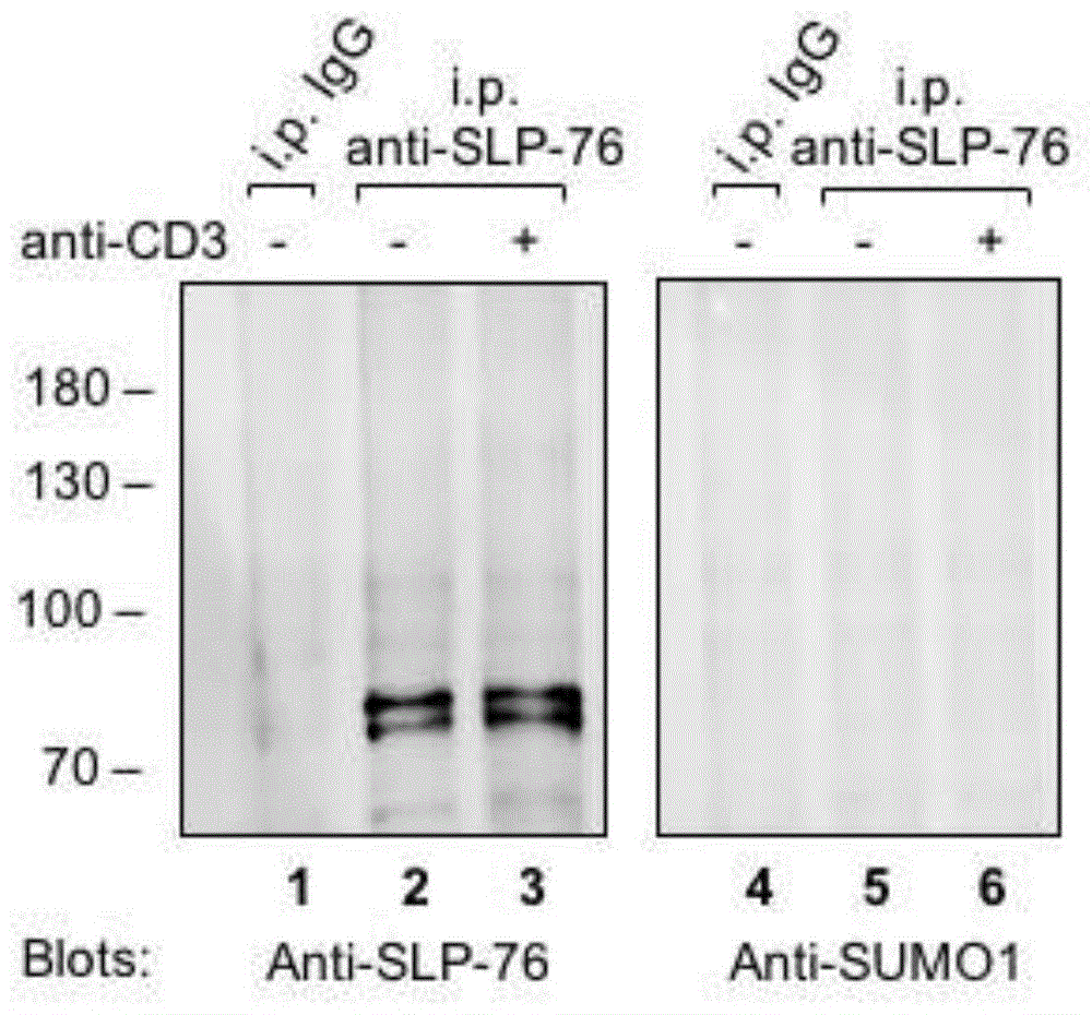 T细胞特异接头蛋白SLP-76类泛素化的方法及相应的体外高效鉴定与流程