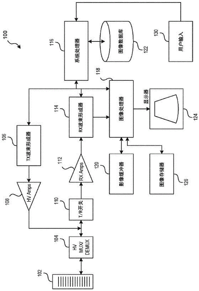 一种具有图像选择器的超声成像设备的制作方法