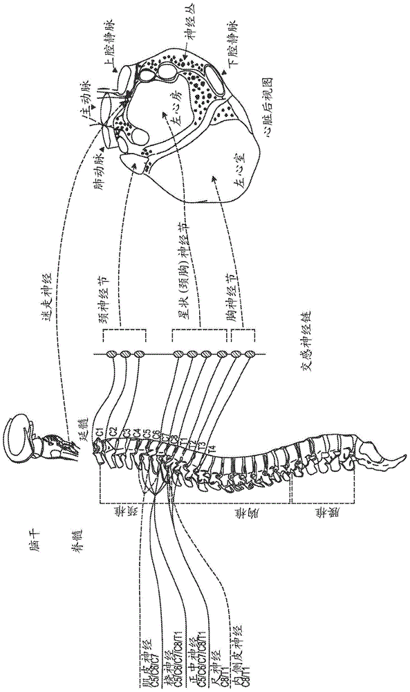 通过周围神经刺激治疗心脏机能障碍的系统和方法与流程