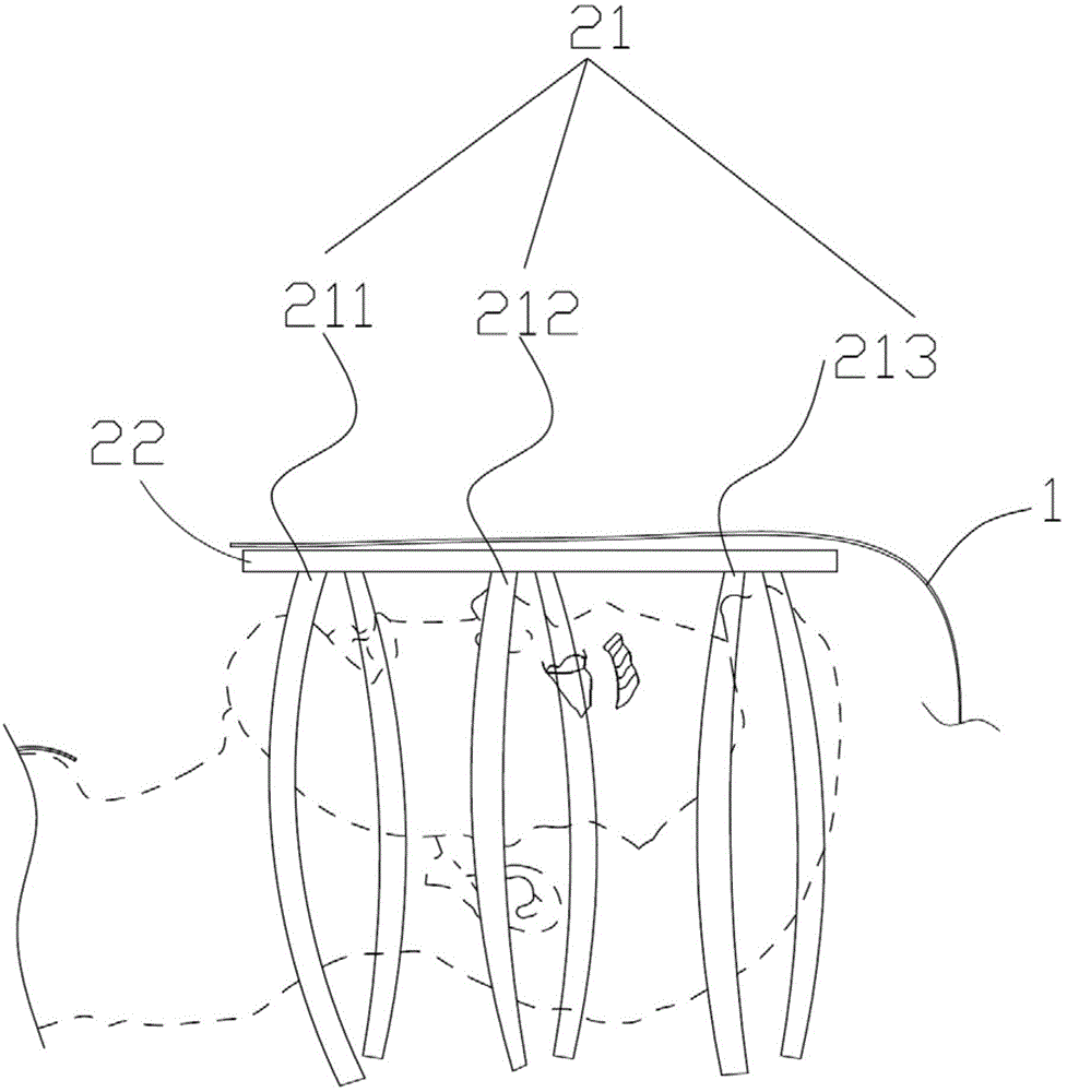 一种无菌巾面部支具的制作方法