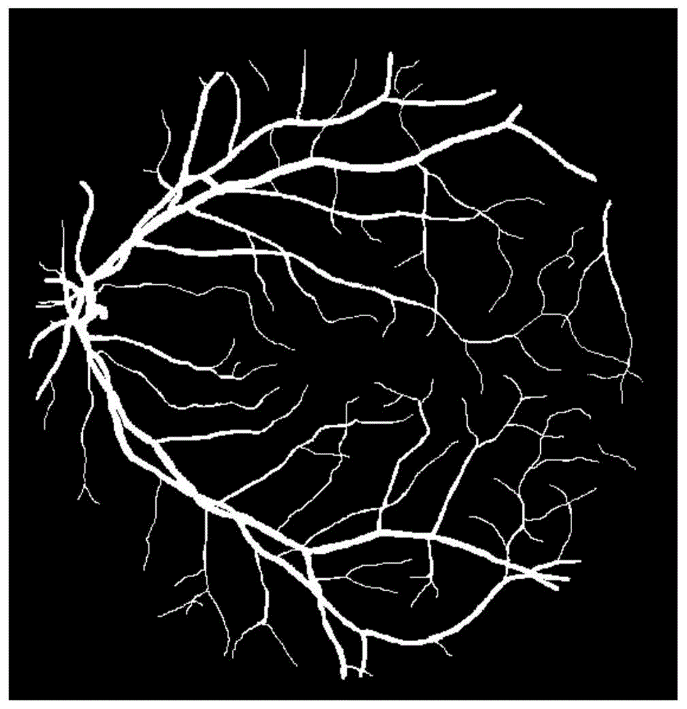 一种基于U-net卷积神经网络的彩色眼底图像血管分割方法与流程