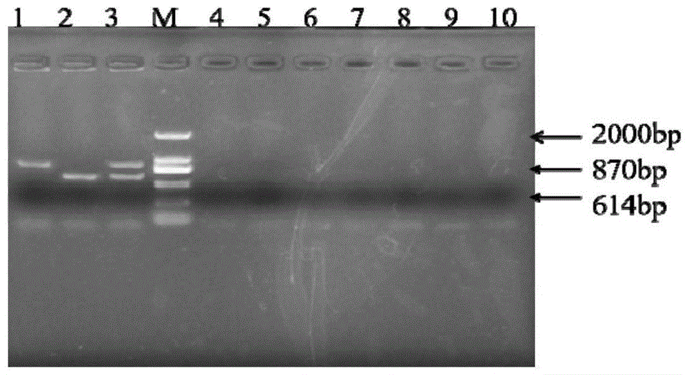 双重PCR早期快速检测无乳链球菌和海豚链球菌的引物及其应用的制作方法