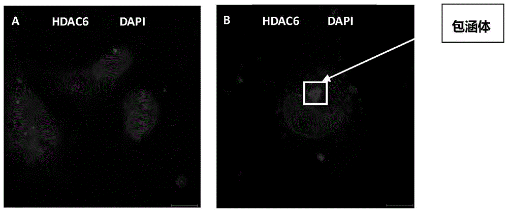 针对HDAC6-cat1区域的纳米抗体及其应用的制作方法