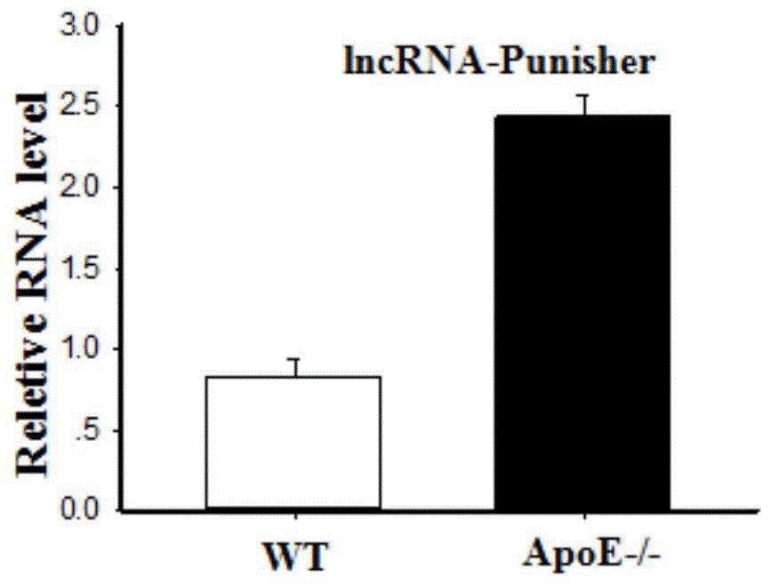 lncRNA和lncRNA抑制剂的应用及应用其的产品的制作方法