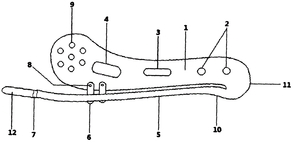 锁骨弹性内固定器的制作方法