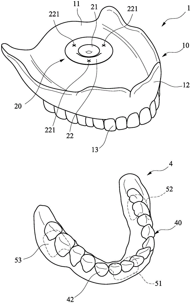 上、下排活动假牙的固着装置的制作方法