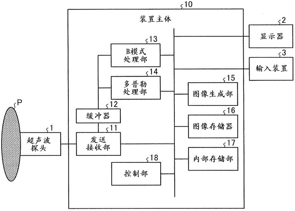 超声波诊断装置以及控制方法与流程