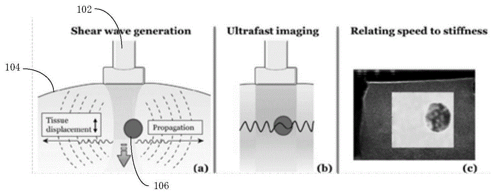 背景技术:剪切波弹性成像(shearwaveelastography)方法是一种新兴的