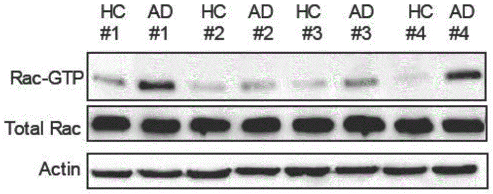 Rac1活性抑制剂在制备治疗阿尔茨海默病的药物中的应用的制作方法