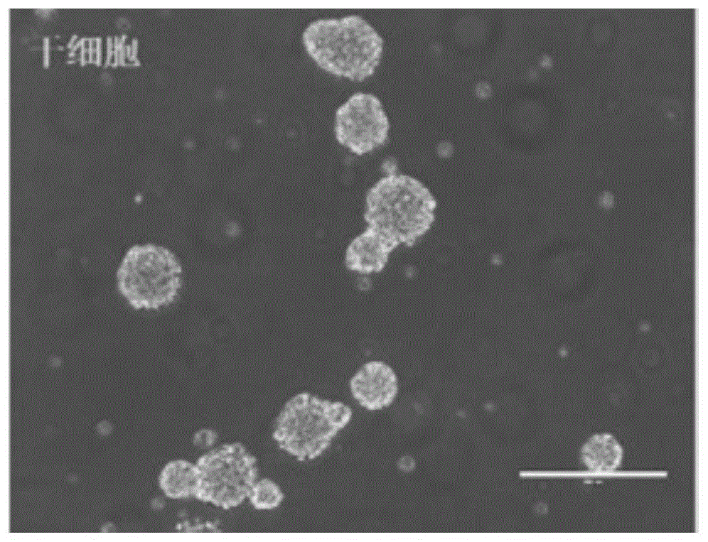 胶质母细胞瘤干细胞原代培养方法与流程