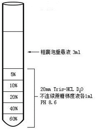 一种尿液小细胞外囊泡的改良提取方法与流程