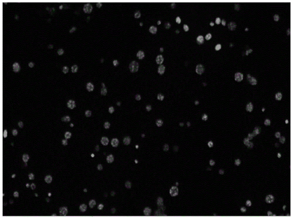 荧光染料DAPI对细胞DNA进行染色定量的癌症筛查和诊断方法与流程