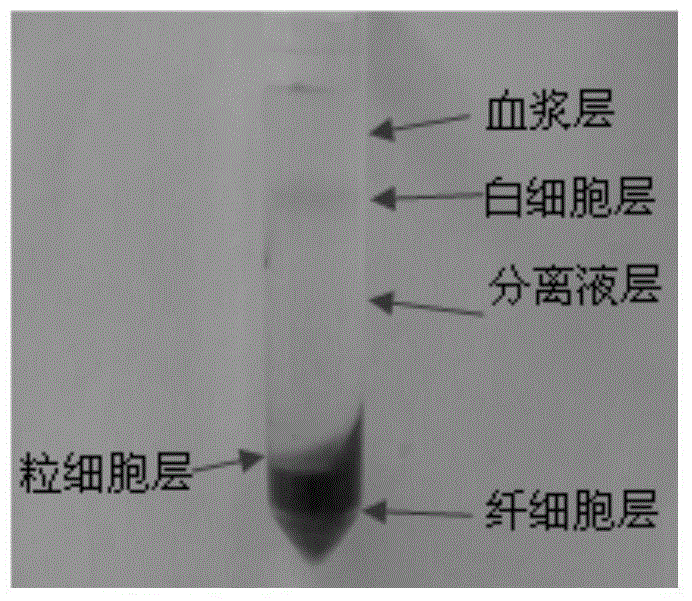 一种团头鲂外周血白细胞分离和原代培养方法与流程