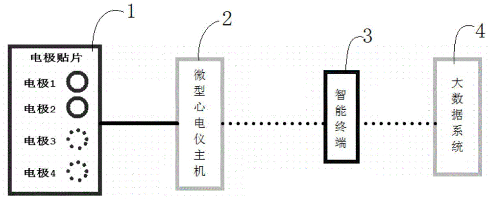 智能穿戴式心电监护系统的制作方法