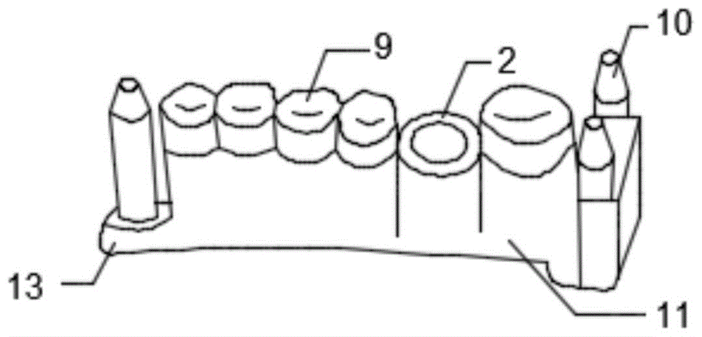 一种3D打印基牙的制作方法