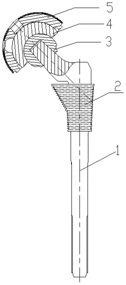 一种3D打印金属骨小梁表面髋关节假体的制作方法