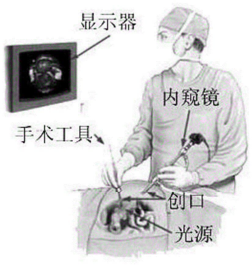 一种面向Kinect医生视角追踪的卡尔曼滤波器的制作方法