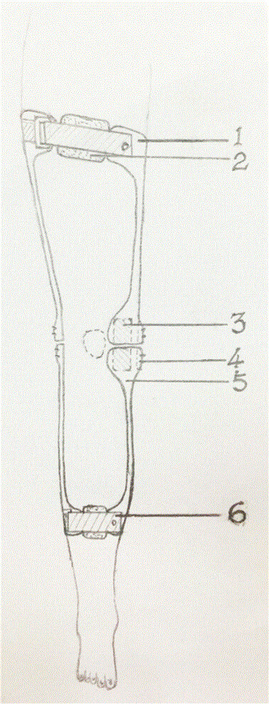 内置式单轴关节防膝过伸矫形器的制作方法
