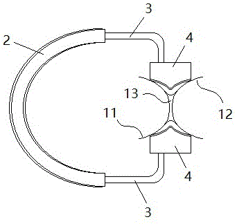 牙体充填修复辅助器械的制作方法