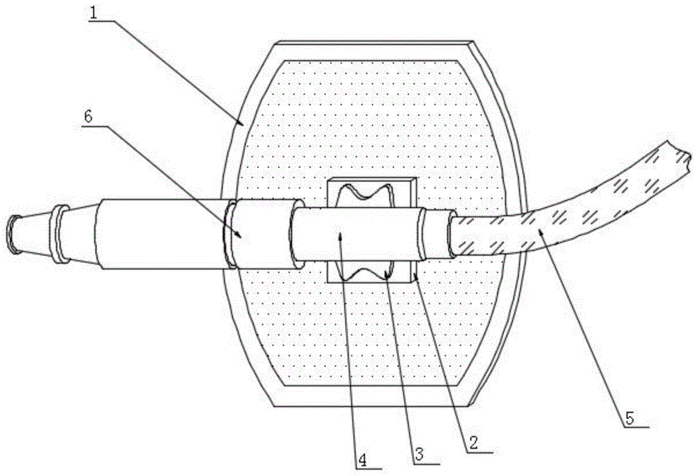一种便于使用的输液港针固定器的制作方法
