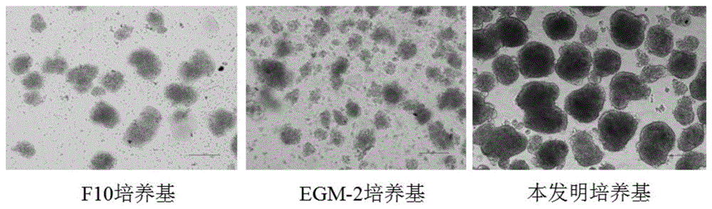 一种青年猪胰岛细胞培养基及其使用方法与流程