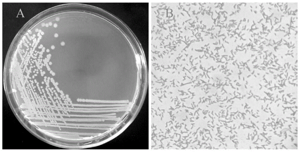 一株富磷和降解有机磷农药的Lysinibacillus macroides及应用的制作方法