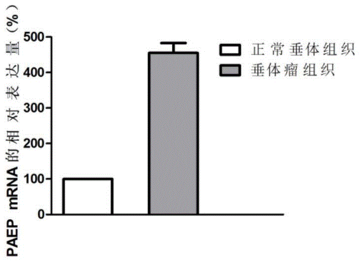 一种诊治垂体瘤的分子标志物的制作方法