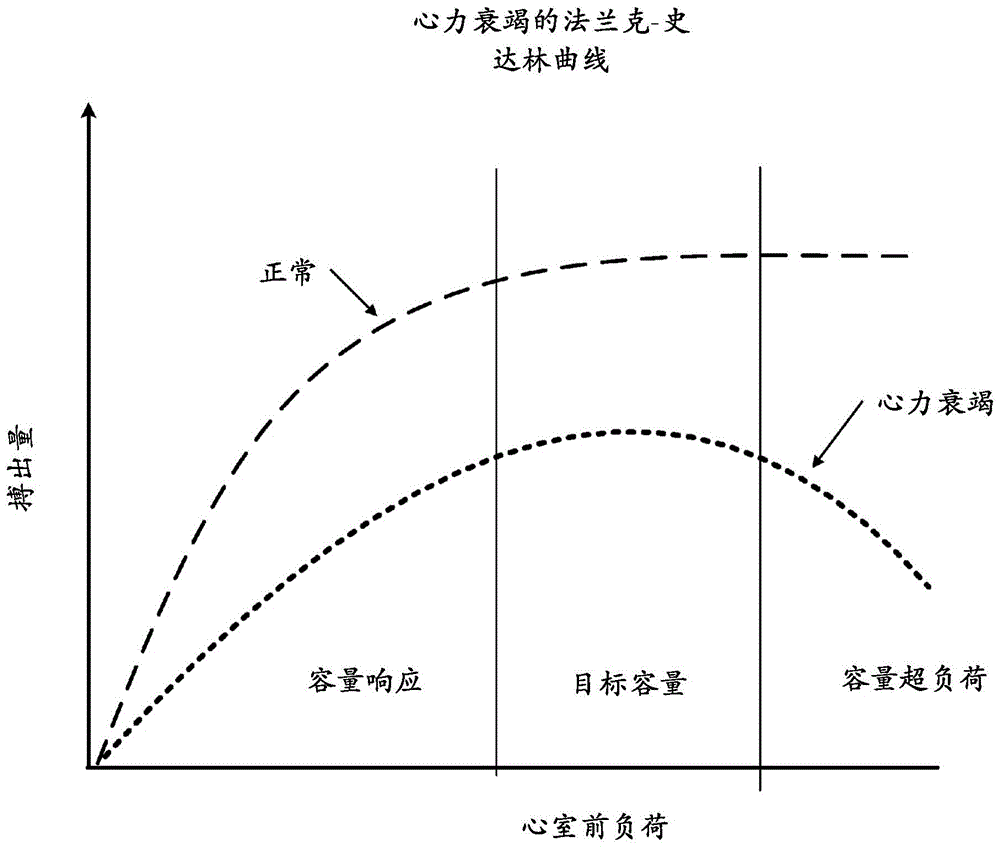 用于中心静脉压测量状态的方法和设备与流程