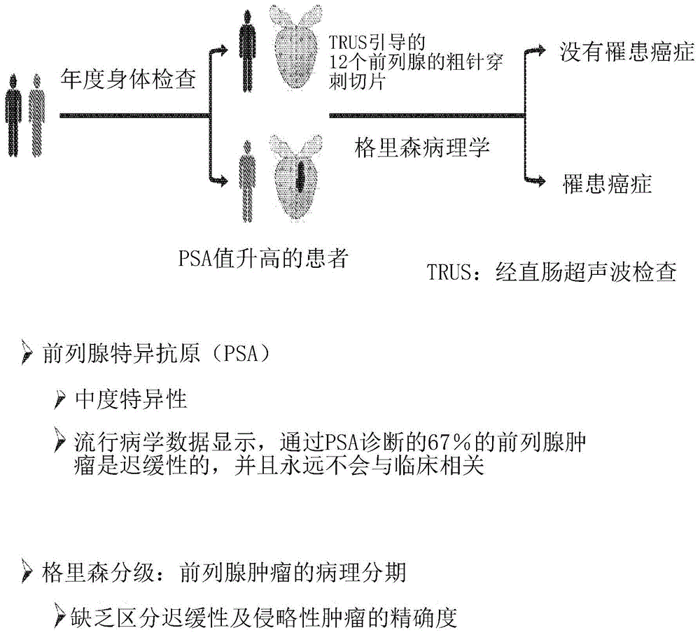 用于前列腺癌诊断及治疗的方法及组合物与流程