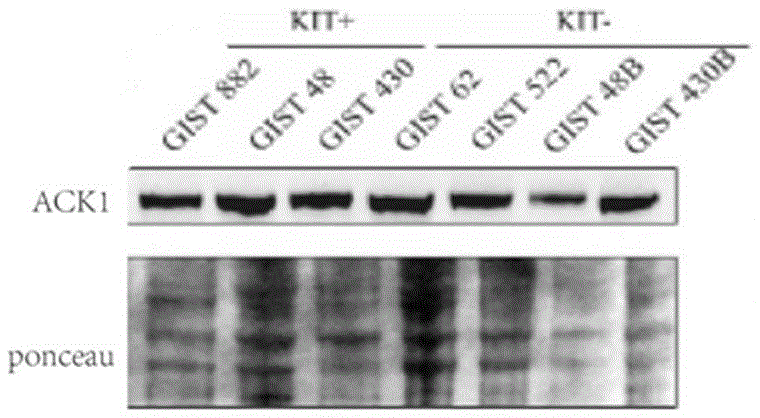 一种用于胃肠道间质肿瘤迁移的标志物ACK1及其应用的制作方法