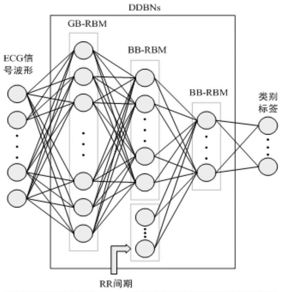 一种基于判别式深度置信网络的心律失常自动分类方法与流程