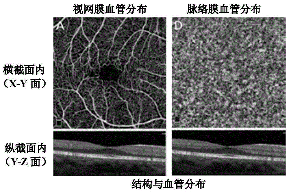 基于全场时域OCT技术的实时血管造影系统与方法与流程