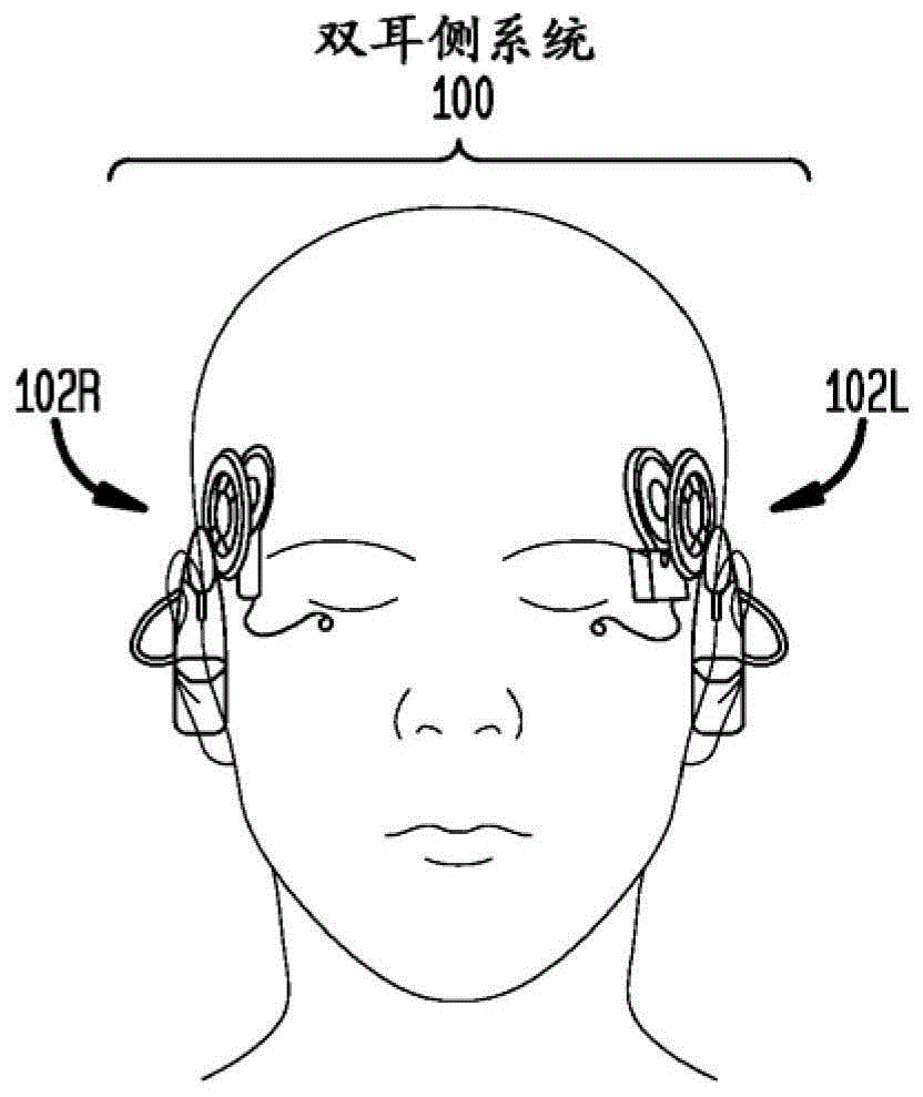 双耳侧系统中的双耳线索保留的制作方法