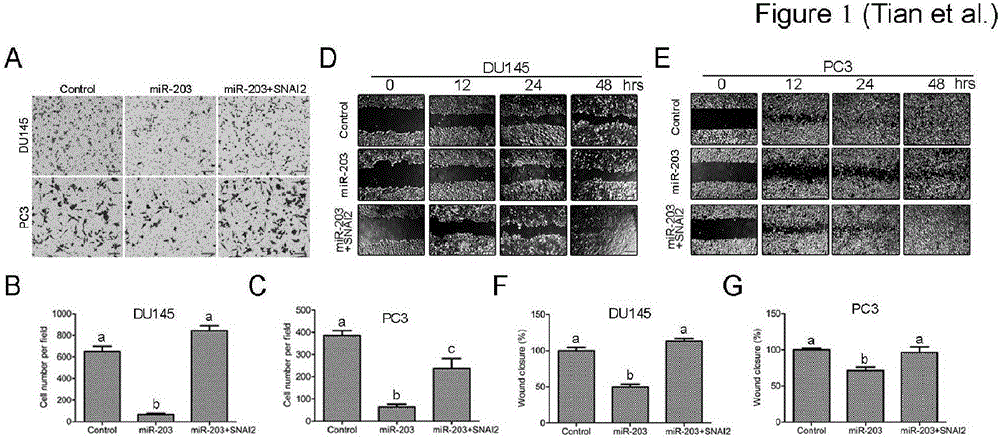 一种利用miR-203/SNAI2轴调节前列腺癌细胞在体外迁移的方法与流程