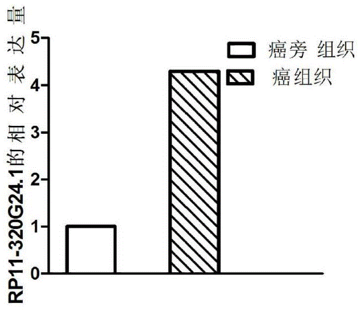 一种与胃腺癌发生发展相关的生物标志物的制作方法