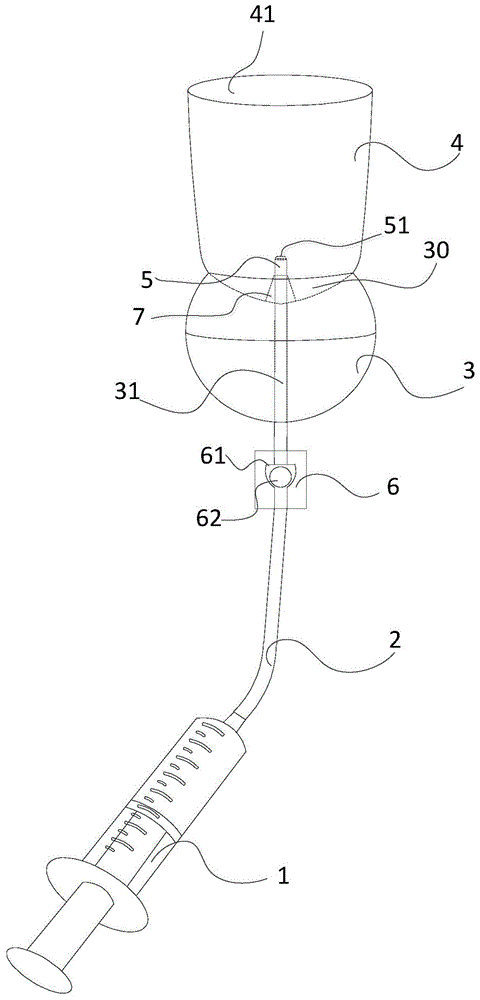 一种逆行尿道造影注射器的制作方法