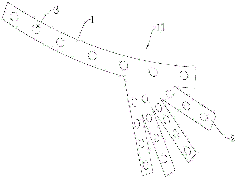 Hoffa骨折固定钢板的制作方法