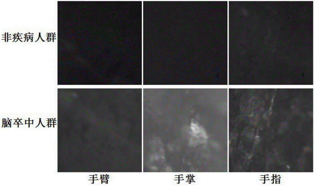 基于角蛋白片段和角蛋白水平及左右对称性的检测判断心脑血管疾病的应用和方法与流程