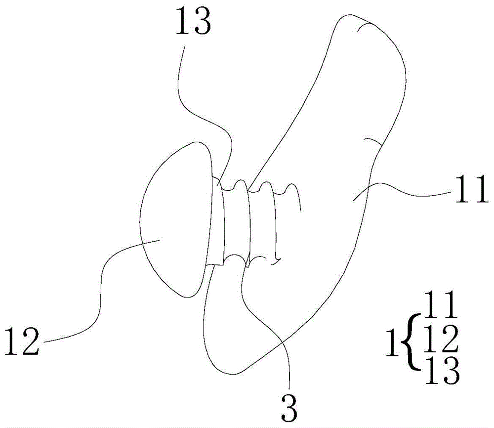 一种矫正器的制作方法