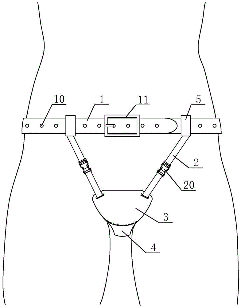 一种盆底肌术后提托装置的制作方法