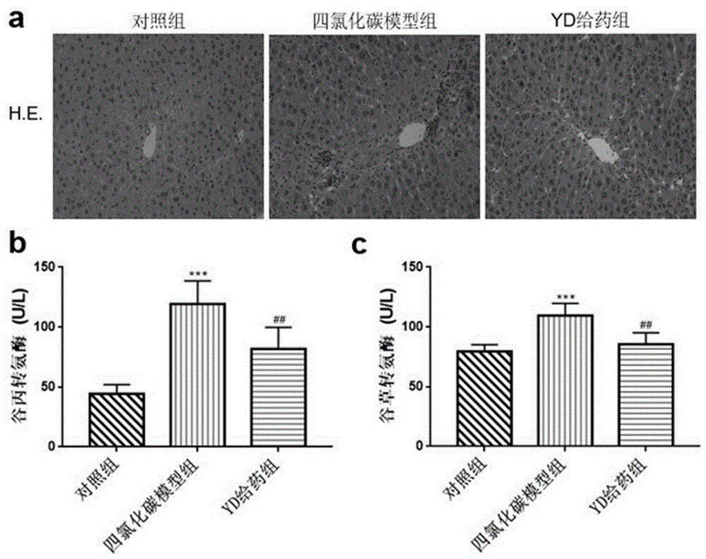 抗菌肽YD在制备治疗肝脏纤维化药物中的应用的制作方法