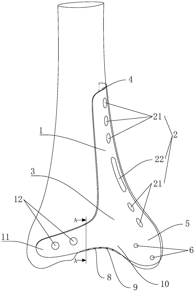 内踝骨解剖钢板的制作方法